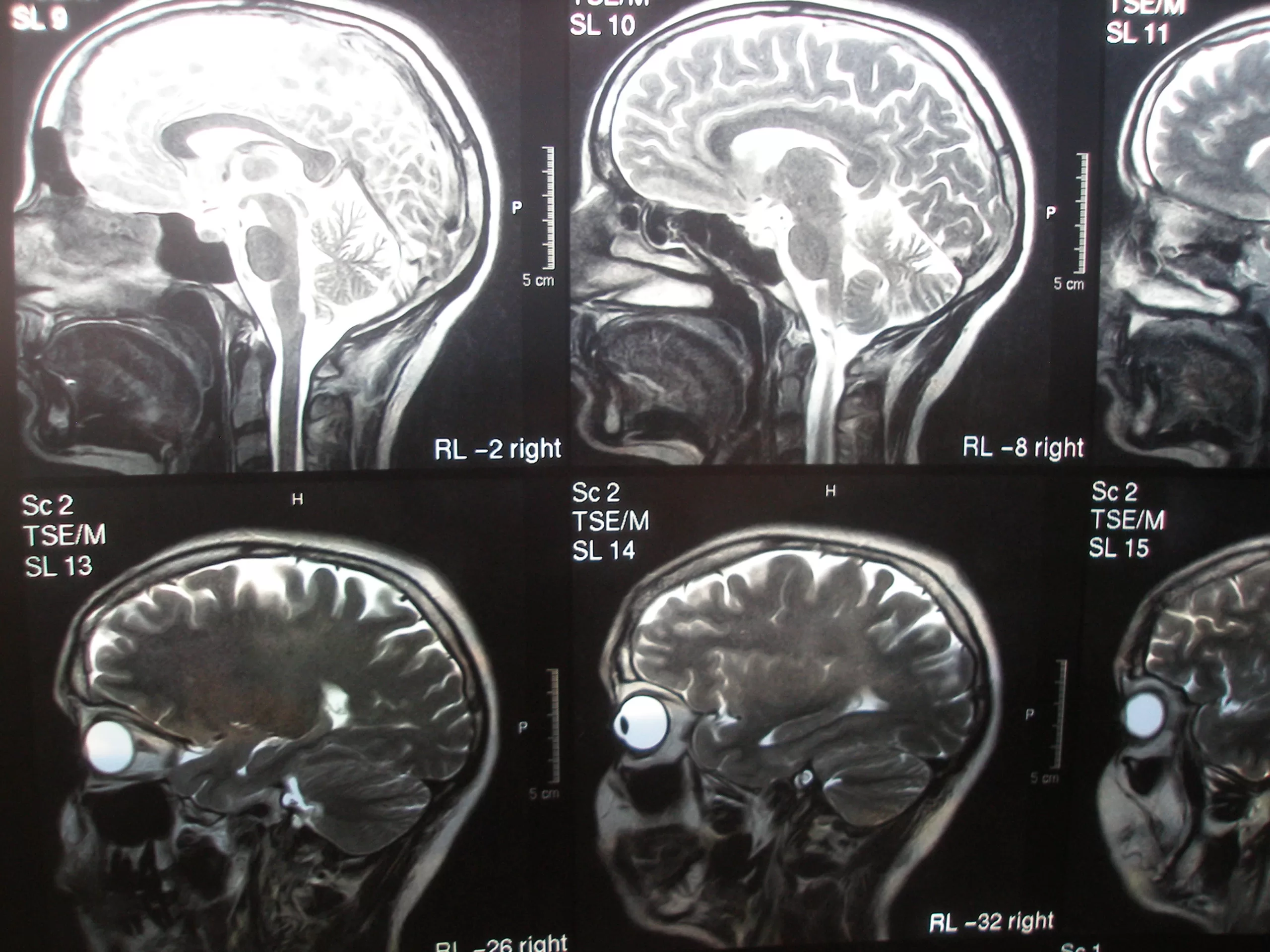 A photograph of a brain scan.